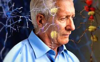 Лечение и профилактика болезни Альцгеймера