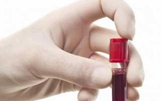 Расшифровка анализа крови биохимический у женщин таблица
