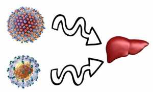 ВИЧ и гепатит: как лечить конфекцию СПИДа и гепатита