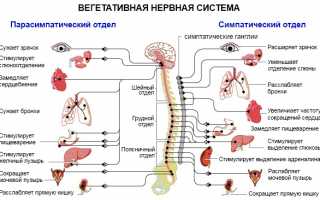 Соматоформная вегетативная дисфункция