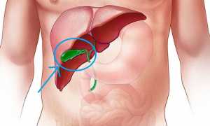 Желчный пузырь: где находится, анатомия, лечение и профилактика