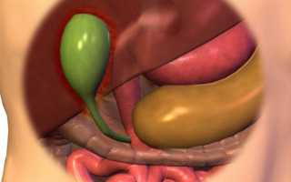 Деформация желчного пузыря: признаки, причины у детей и взрослых