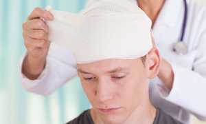 Лечение последствий черепно мозговой травмы