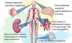 Сахарный диабет вики