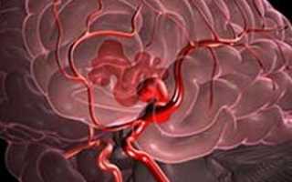 Кровоизлияние в мозг после удара головой