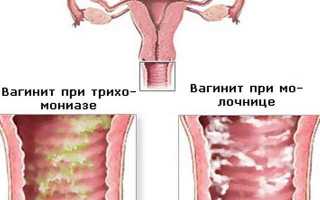 Инструкция по применению препарата Флагил от паразитов и глистов