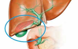 Бескаменный холецистит: виды, признаки, как лечить