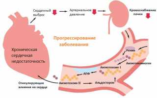 Правожелудочковая недостаточность