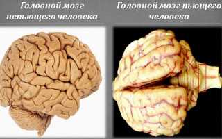 Варианты психоорганического синдрома и его проявления