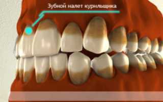 Как очистить зубы от никотина в домашних условиях