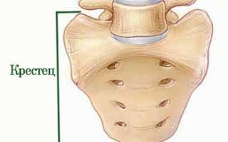 Ушиб копчика при падении: что делать, симптомы, лечение и последствия