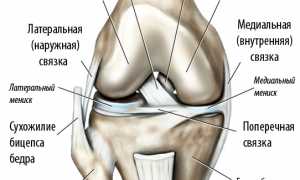 Растяжение связок коленного сустава: признаки, причины, диагностика и лечение