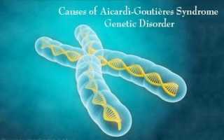 Причины и лечение синдрома айкарди гутьереса
