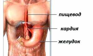 Ахалазия кардии: причины, симптомы, методы лечения