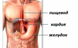 Ахалазия кардии: причины, симптомы, методы лечения