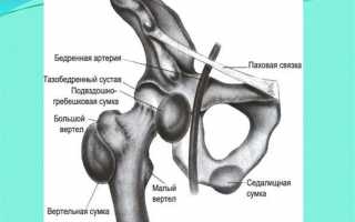 Вертельный бурсит: особенности заболевания, симптоматика и лечение