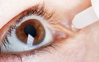 Сухой глаз: симптомы лечение