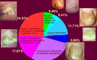 Народные средства от грибка ногтей на ногах Лечим быстро и просто